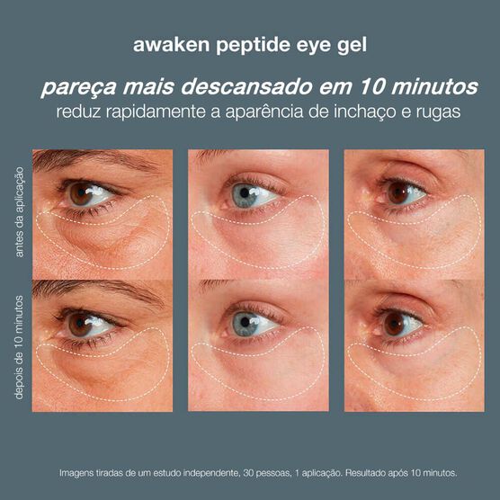 DERMALOGIC SKN H AW PEPT EYE  15ML